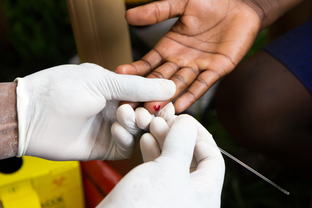 needle spliting skin to extract blood for tests, blood test